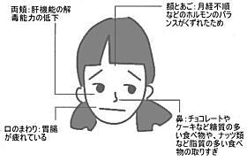 にきび,髪