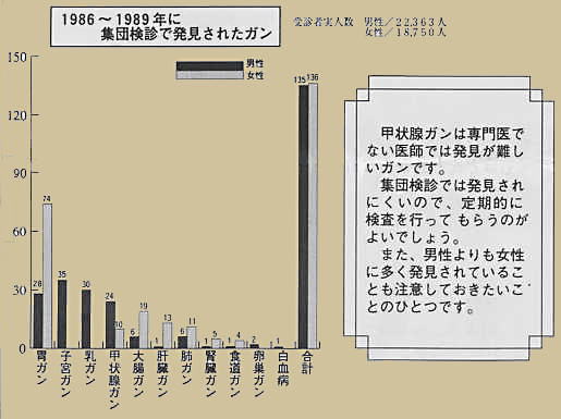 集団検診で発見されたガン