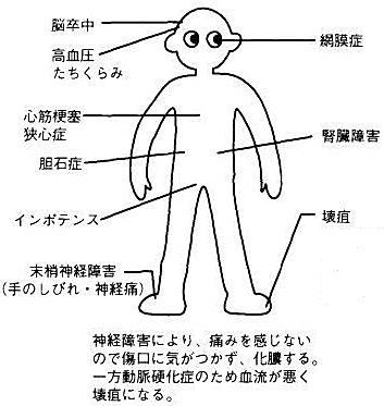 糖尿病２