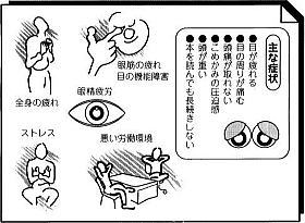 眼精疲労